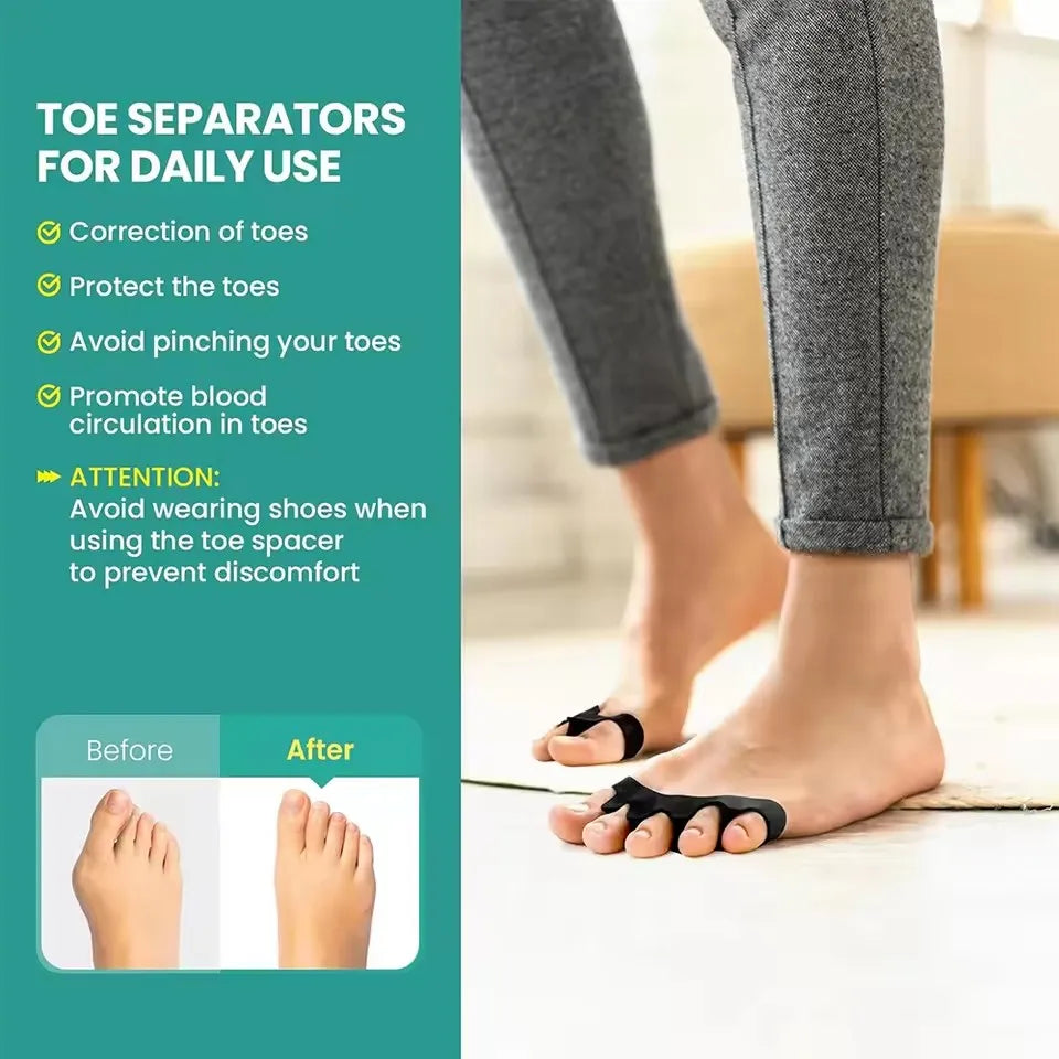 Toe Separators Doctor Recommended Correct Foot and Bunion Pain,Plantar Fasciitis Toe Straightener To Improve Functional Mobility