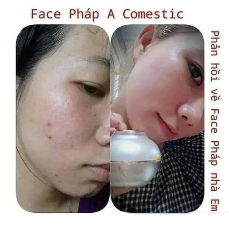 Kem Dưỡng Trắng Da Face Pháp A Cosmetic 20g Mẫu Mới, Brighten Skin, Hydrate & Nourish, Whitening Facial Care
