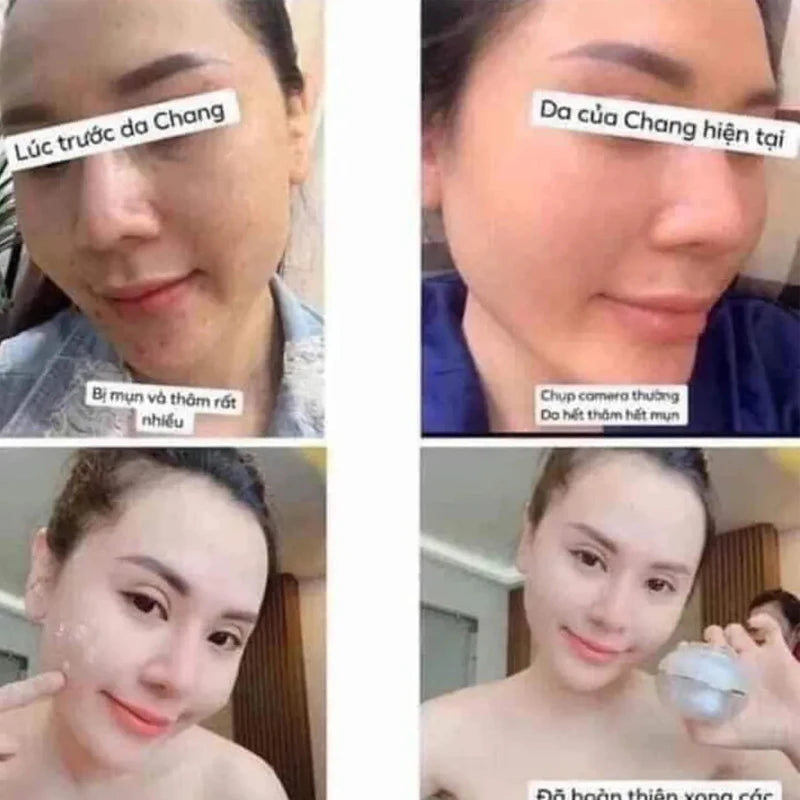 Kem Dưỡng Trắng Da Face Pháp A Cosmetic 20g Mẫu Mới, Brighten Skin, Hydrate & Nourish, Whitening Facial Care